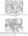 Fig. 26 - Methods for treating lung disorders