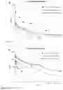 Fig. 30 - Methods for treating lung disorders