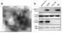 Fig. 01 - Exosome preparation for treating disease and application thereof