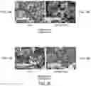 Fig. 03 - FORMULATIONS OF ENZALUTAMIDE