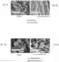 Fig. 04 - FORMULATIONS OF ENZALUTAMIDE