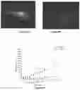 Fig. 06 - Application of clofoctol for manufacturing pharmaceutical product for treating human neuroglioma