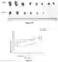 Fig. 07 - Application of clofoctol for manufacturing pharmaceutical product for treating human neuroglioma