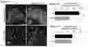 Fig. 12 - METHODS OF TREATING PSYCHIATRIC STRESS DISORDERS