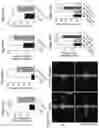 Fig. 16 - METHODS OF TREATING PSYCHIATRIC STRESS DISORDERS