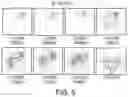 Fig. 07 - ACAMPROSATE FORMULATIONS, METHODS OF USING THE SAME, AND COMBINATIONS COMPRISING THE SAME