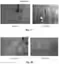 Fig. 02 - Health functional food for reducing and preventing capillary hemorrhage