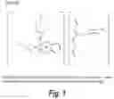 Fig. 02 - Semi-solid topical composition containing pirfenidone and modified diallyl disulfide oxide (M-DDO) for eliminating or preventing acne