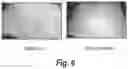 Fig. 07 - Semi-solid topical composition containing pirfenidone and modified diallyl disulfide oxide (M-DDO) for eliminating or preventing acne