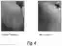 Fig. 09 - Semi-solid topical composition containing pirfenidone and modified diallyl disulfide oxide (M-DDO) for eliminating or preventing acne