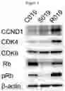 Fig. 03 - Method for preventing or treating tumor diseases with a combination of tyrosine kinase inhibitor and CDK4/6 inhibitor