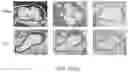 Fig. 23 - COMPOUNDS, COMPOSITIONS AND METHODS USEFUL FOR CHOLESTEROL MOBILIZATION