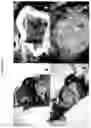Fig. 02 - Silicate containing compositions and methods of treatment