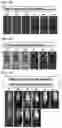 Fig. 41 - Engineering stem cells for cancer therapy