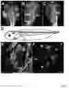 Fig. 02 - Compositions and methods to restore hearing loss and balance through embryonic ear transplant