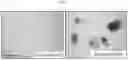 Fig. 04 - METHODS FOR MAKING AND USING DEDIFFERENTIATED AND STEM-LIKE HUMAN CELLS