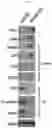 Fig. 06 - METHODS FOR MAKING AND USING DEDIFFERENTIATED AND STEM-LIKE HUMAN CELLS