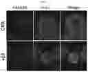 Fig. 14 - METHODS FOR MAKING AND USING DEDIFFERENTIATED AND STEM-LIKE HUMAN CELLS