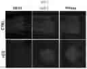Fig. 15 - METHODS FOR MAKING AND USING DEDIFFERENTIATED AND STEM-LIKE HUMAN CELLS