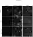 Fig. 23 - METHODS FOR MAKING AND USING DEDIFFERENTIATED AND STEM-LIKE HUMAN CELLS