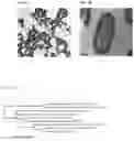Fig. 04 - Strain having ability to inhibit obesity and pharmaceutical composition containing same