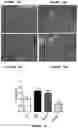 Fig. 14 - METHOD OF TREATING OVERWEIGHT OR OBESITY COMPRISING ADMINISTERING A PLEUROTUS OSTREATUS MUSHROOM EXTRACT OR A COMPOSITION COMPRISING A PLEUROTUS OSTRETUS MUSHROOM EXTRACT