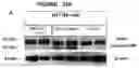 Fig. 17 - METHOD OF TREATING OVERWEIGHT OR OBESITY COMPRISING ADMINISTERING A PLEUROTUS OSTREATUS MUSHROOM EXTRACT OR A COMPOSITION COMPRISING A PLEUROTUS OSTRETUS MUSHROOM EXTRACT