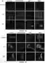 Fig. 20 - METHOD OF TREATING OVERWEIGHT OR OBESITY COMPRISING ADMINISTERING A PLEUROTUS OSTREATUS MUSHROOM EXTRACT OR A COMPOSITION COMPRISING A PLEUROTUS OSTRETUS MUSHROOM EXTRACT