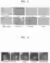 Fig. 06 - Method of treating dry eye syndrome using pharmaceutical composition having extract of or fraction thereof