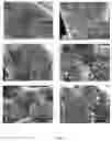 Fig. 09 - Composition for use in the treatment of intestinal alterations