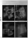 Fig. 30 - METHODS AND COMPOSITIONS FOR PREVENTING OR TREATING OPHTHALMIC CONDITIONS