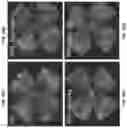 Fig. 31 - METHODS AND COMPOSITIONS FOR PREVENTING OR TREATING OPHTHALMIC CONDITIONS