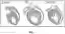 Fig. 02 - COMPOSITIONS AND METHODS FOR TREATING HEART FAILURE