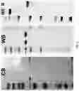 Fig. 12 - Use of vimentin in the modulation of acute inflammation and thrombosis