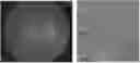 Fig. 01 - NON-LEAKING OR MINIMALLY-LEAKING CHOROIDAL OR RETINAL REVASCULARIZATION