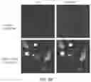 Fig. 09 - Restoration of tumor suppression using MRNA-based delivery system