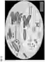 Fig. 17 - METHODS OF TREATING CANCER WITH THE COMBINATION OF GRANZYME A GENE DELIVERY AND HSP90 INHIBITION