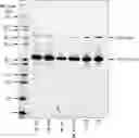 Fig. 01 - Polysaccharide-protein conjugates utilizing diphtheria toxin fragment B as a carrier