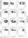 Fig. 17 - Newcastle disease viruses and uses thereof