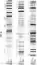Fig. 12 - Prefusion coronavirus spike proteins and their use