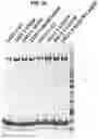 Fig. 15 - Prefusion coronavirus spike proteins and their use