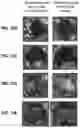 Fig. 11 - Single wall nanotube constructs and uses thereof