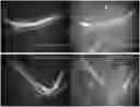 Fig. 01 - Nerve labeling compositions and uses thereof