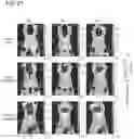 Fig. 43 - Bi-specific antibodies and uses thereof