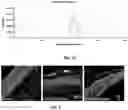 Fig. 08 - Method of delivering genes and drugs to a posterior segment of an eye