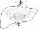 Fig. 01 - METHODS FOR DELIVERING GENE EDITING REAGENTS TO CELLS WITHIN ORGANS