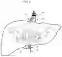 Fig. 09 - METHODS FOR DELIVERING GENE EDITING REAGENTS TO CELLS WITHIN ORGANS