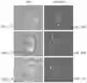 Fig. 35 - Tumor specific antibody conjugates and uses therefor