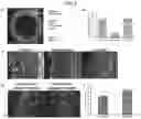Fig. 05 - Method for protecting skeletonized blood vessels