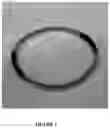 Fig. 02 - Apparatuses and methods for treating ophthalmic diseases and disorders